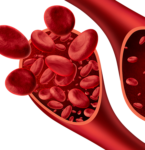 Imagen del curso Clasificación de las anemias
